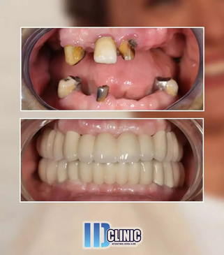 Slider image (2) IDC International Dental Clinic